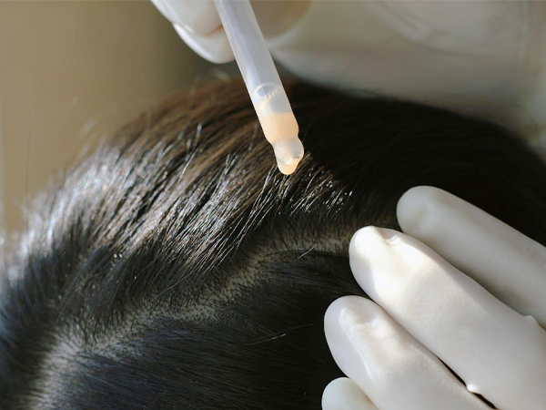 Scalp Balance image